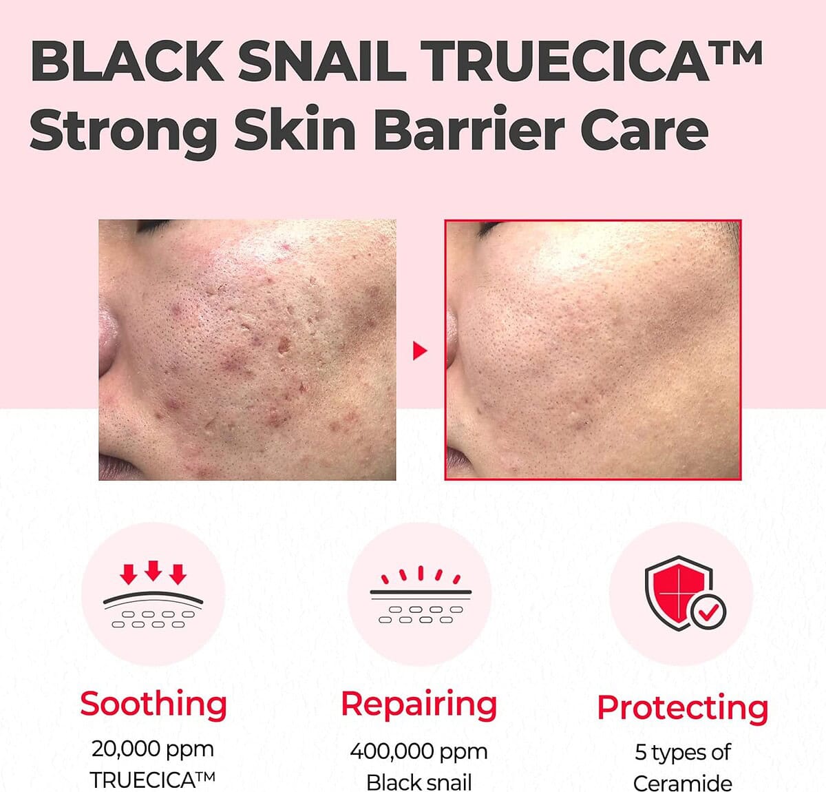 Some by mi snail truecica miracle repair cream - best price on stylekorean arabia